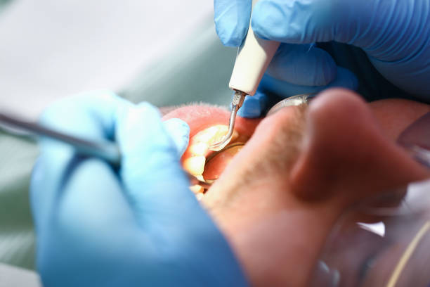 Best Emergency Dental Care for Broken or Chipped Teeth in River Oaks, TX