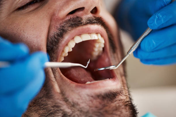 River Oaks, TX Emergency Dentist Pros