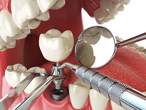 Best Same-Day Emergency Dental Services in River Oaks, TX