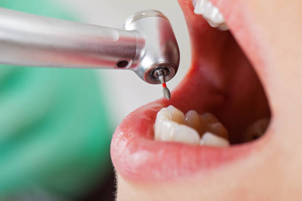 Best Cosmetic Emergency Dentistry in River Oaks, TX